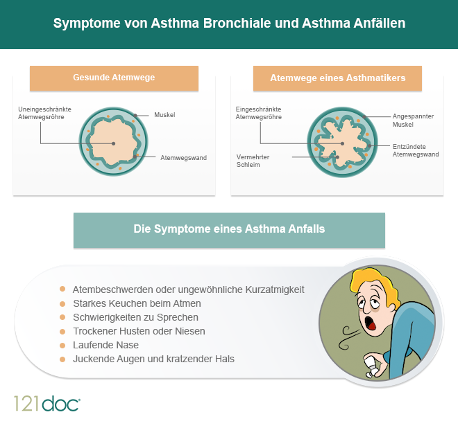 Asthma und Erkältung - ist das gefährlich? | 121doc