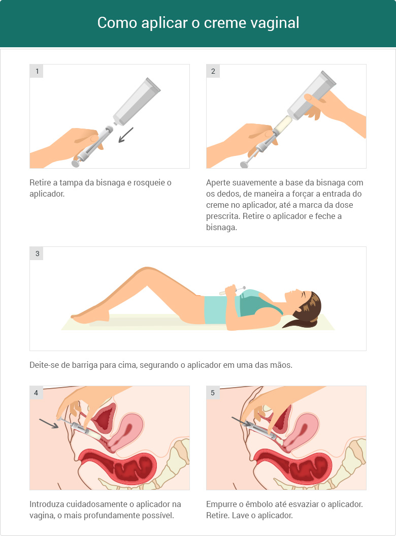 Como aplicar creme vaginal clindamicina