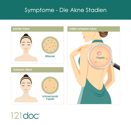 Akne Symptome
