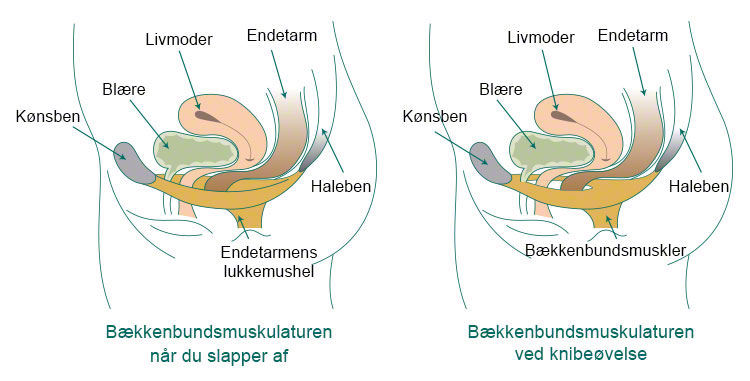 illustration af knibeøvelser i hvile og aktivitet, og bækkenbundsmusklernes betydning for at holde på urinen og undgå inkontinens