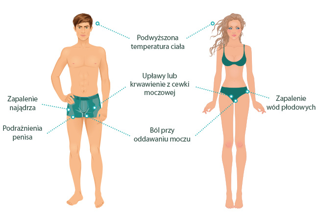 Ureaplasma • Przyczyny Objawy Leczenie • 121doc® 5296