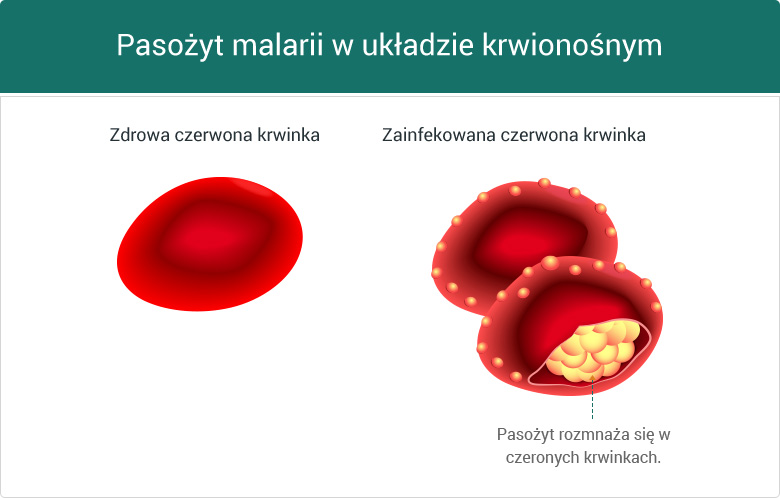 Pasożyty malarii w czerwonych krwinkach - grafika